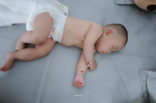 荣成宝宝头上长痱子 荣成宝宝头上长痱子